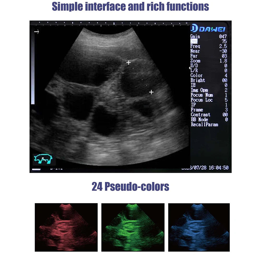 Dawei Portable Veterinary Ultrasound Scanner For Pregnancy Testing